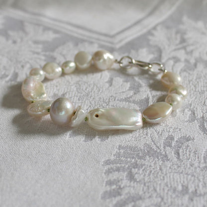 A mixed pearl bracelet with a silver clasp, showing a blemish on a large pearl, resting on a textured white damask fabric background.